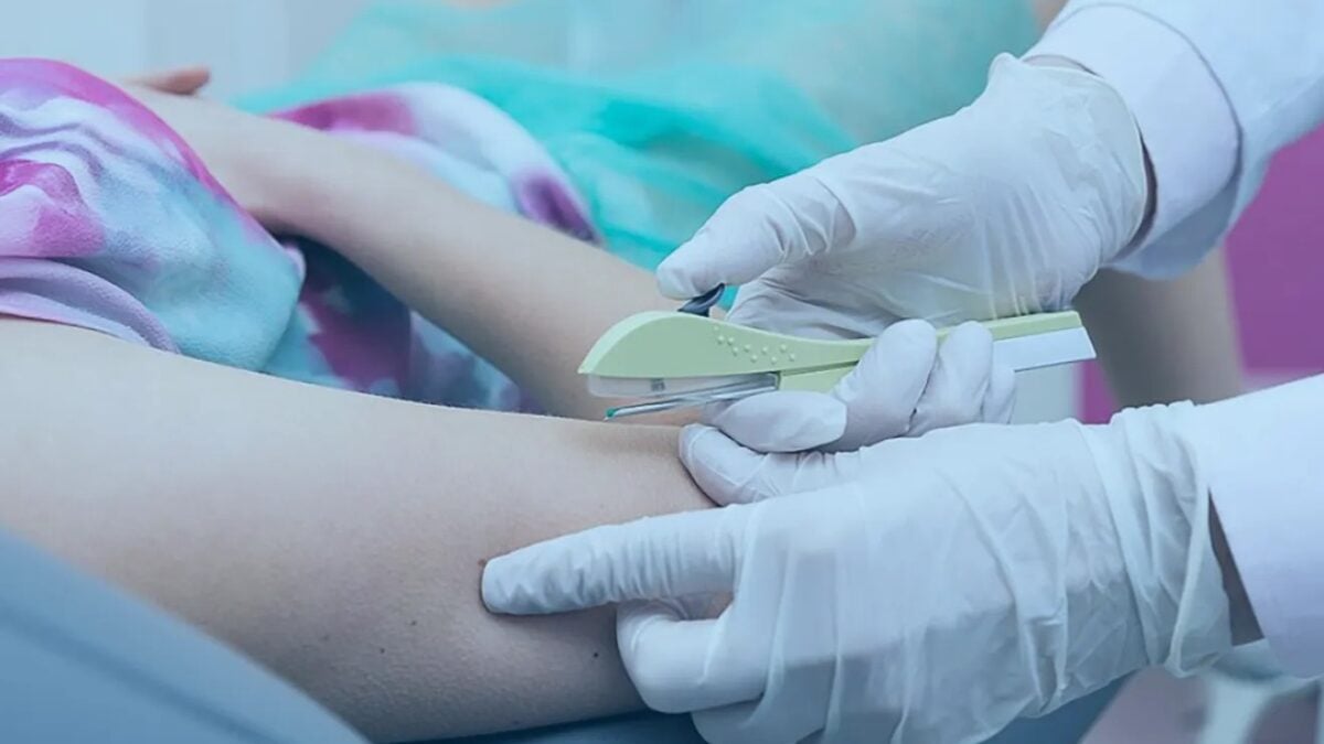Ministério da Saúde recebe primeiras unidades de implante contraceptivo para o SUS