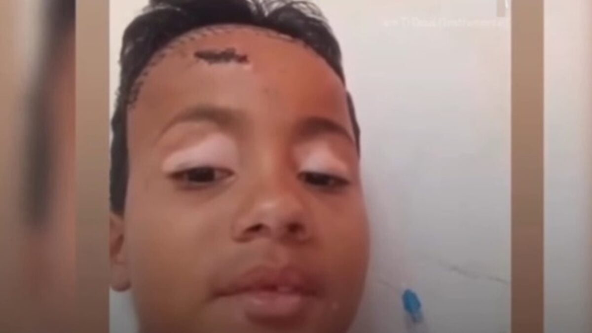 Menino espancado no lugar do irmão em Caldas Novas desperta do coma; família pede ajuda